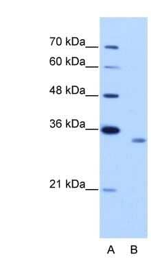 Western Blot: RBM4B Antibody [NBP1-80469]