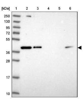 Western Blot: RBM4 Antibody [NBP2-33503]