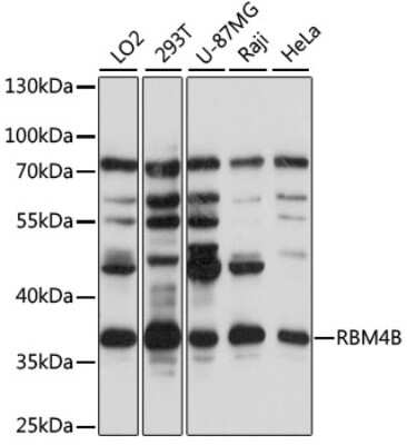 Western Blot: RBM4B AntibodyAzide and BSA Free [NBP2-93750]