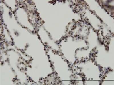 Immunohistochemistry-Paraffin: RBM5 Antibody (2B6) [H00010181-M01]
