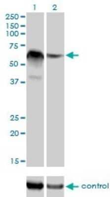 Western Blot: RBM5 Antibody (2B6) [H00010181-M01]