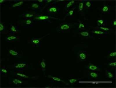 Immunocytochemistry/ Immunofluorescence: RBM5 Antibody (3G6) [H00010181-M02]