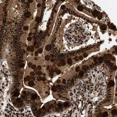 Immunohistochemistry-Paraffin: RBM5 Antibody [NBP1-83304]