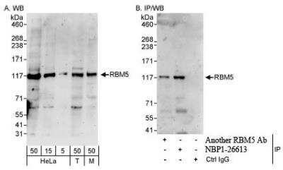 Western Blot: RBM5 Antibody [NBP1-26613]