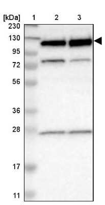 Western Blot: RBM5 Antibody [NBP1-83304]