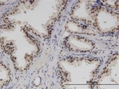 Immunohistochemistry-Paraffin: RBM6 Antibody (3E9) [H00010180-M02]