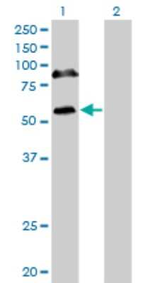 Western Blot: RBM6 Antibody (4B3) [H00010180-M16]