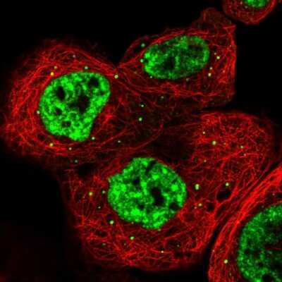 Immunocytochemistry/ Immunofluorescence: RBM6 Antibody [NBP1-89377]