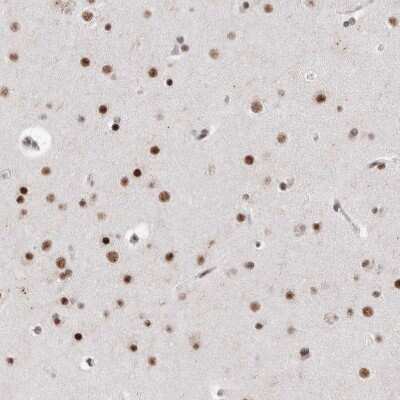 Immunohistochemistry-Paraffin: RBM6 Antibody [NBP1-89377]