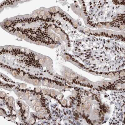 Immunohistochemistry-Paraffin: RBM6 Antibody [NBP1-89377]