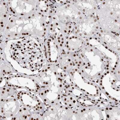 Immunohistochemistry-Paraffin: RBM6 Antibody [NBP1-89377]
