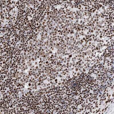 Immunohistochemistry-Paraffin: RBM6 Antibody [NBP1-89377]