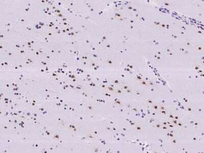 Immunohistochemistry-Paraffin: RBM6 Antibody [NBP2-97851]