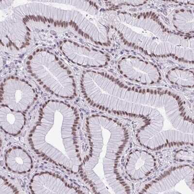 Immunohistochemistry: RBM7 Antibody [NBP2-38570]