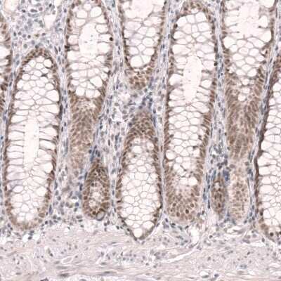Immunohistochemistry-Paraffin: RBM7 Antibody [NBP1-86080]