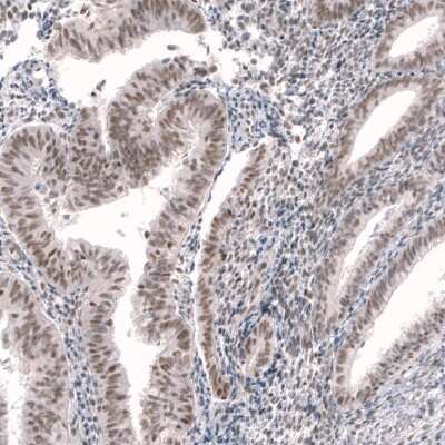 Immunohistochemistry-Paraffin: RBM7 Antibody [NBP1-86080]