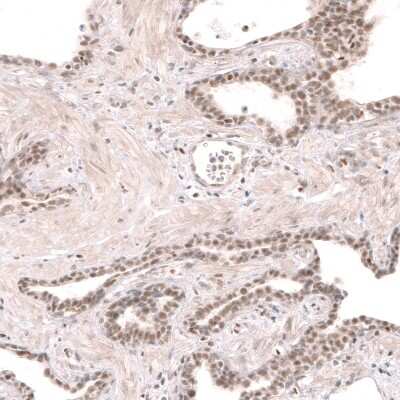 Immunohistochemistry-Paraffin: RBM7 Antibody [NBP1-86080]