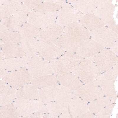 Immunohistochemistry-Paraffin: RBM7 Antibody [NBP1-86080]