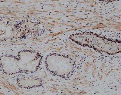 Immunohistochemistry-Paraffin: RBM7 Antibody [NBP1-86080]