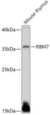 Western Blot: RBM7 AntibodyAzide and BSA Free [NBP2-94284]