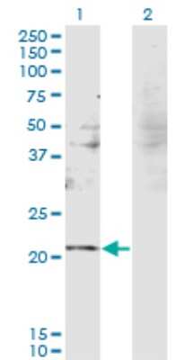 Western Blot: RBM8A Antibody (3E4) [H00009939-M08]