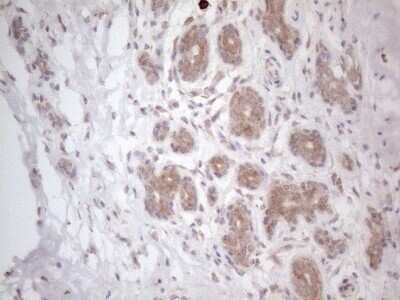 Immunohistochemistry: RBMS1 Antibody (OTI2H1) [NBP2-45533]
