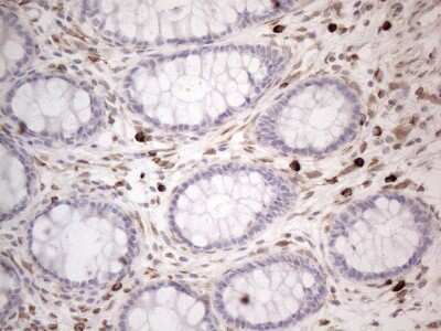 Immunohistochemistry: RBMS1 Antibody (OTI2H1) [NBP2-45533]