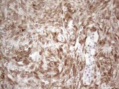 Immunohistochemistry: RBMS1 Antibody (OTI2H1) [NBP2-45533]