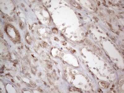 Immunohistochemistry: RBMS1 Antibody (OTI2H1) [NBP2-45533]