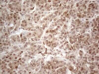 Immunohistochemistry: RBMS1 Antibody (OTI2H1) [NBP2-45533]