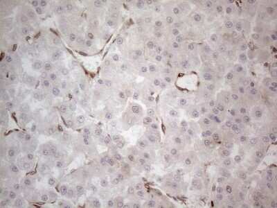 Immunohistochemistry: RBMS1 Antibody (OTI2H1) [NBP2-45533]