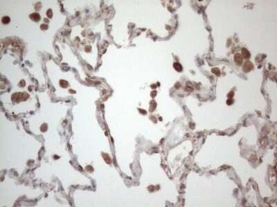 Immunohistochemistry: RBMS1 Antibody (OTI2H1) [NBP2-45533]