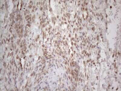 Immunohistochemistry: RBMS1 Antibody (OTI2H1) [NBP2-45533]