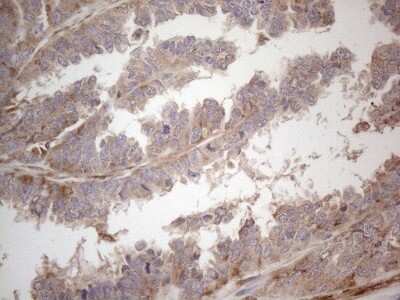 Immunohistochemistry: RBMS1 Antibody (OTI2H1) [NBP2-45533]