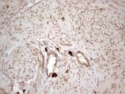 Immunohistochemistry: RBMS1 Antibody (OTI2H1) [NBP2-45533]