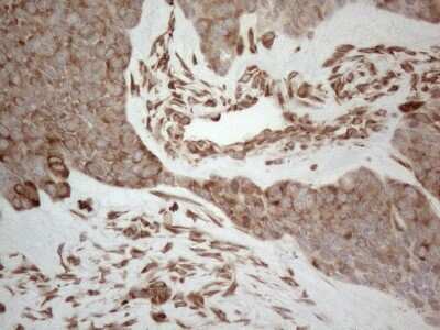 Immunohistochemistry: RBMS1 Antibody (OTI2H1) [NBP2-45533]