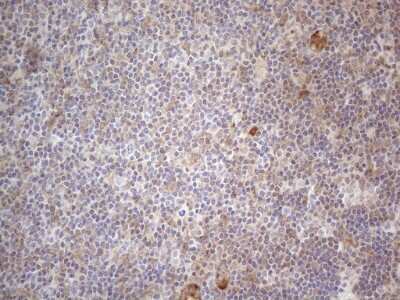 Immunohistochemistry: RBMS1 Antibody (OTI2H1) [NBP2-45533]