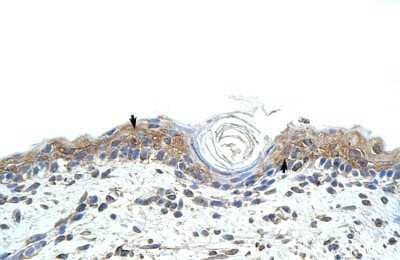 Immunohistochemistry-Paraffin: RBMS1 Antibody [NBP1-58231]