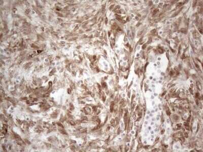 Immunohistochemistry: RBMS1 Antibody (OTI2H1) - Azide and BSA Free [NBP2-73834]