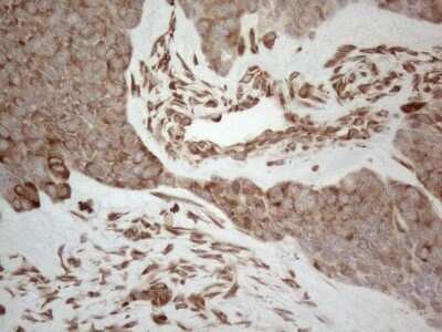 Immunohistochemistry: RBMS1 Antibody (OTI2H1) - Azide and BSA Free [NBP2-73834]