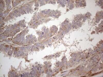 Immunohistochemistry: RBMS1 Antibody (OTI2H1) - Azide and BSA Free [NBP2-73834]