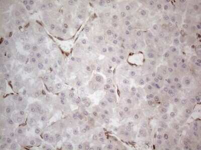 Immunohistochemistry: RBMS1 Antibody (OTI2H1) - Azide and BSA Free [NBP2-73834]