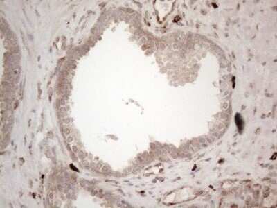 Immunohistochemistry: RBMS1 Antibody (OTI2H1) - Azide and BSA Free [NBP2-73834]