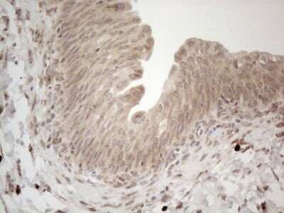 Immunohistochemistry: RBMS1 Antibody (OTI2H1) - Azide and BSA Free [NBP2-73834]