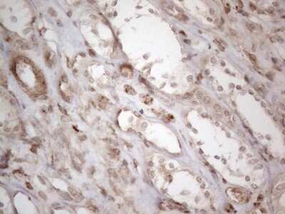 Immunohistochemistry: RBMS1 Antibody (OTI2H1) - Azide and BSA Free [NBP2-73834]
