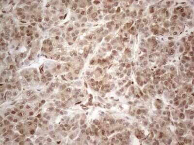 Immunohistochemistry: RBMS1 Antibody (OTI2H1) - Azide and BSA Free [NBP2-73834]