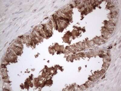 Immunohistochemistry: RBMS1 Antibody (OTI2H1) - Azide and BSA Free [NBP2-73834]