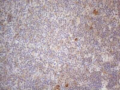 Immunohistochemistry: RBMS1 Antibody (OTI2H1) - Azide and BSA Free [NBP2-73834]