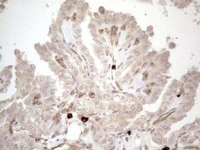 Immunohistochemistry: RBMS1 Antibody (OTI2H1) - Azide and BSA Free [NBP2-73834]