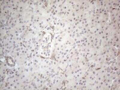 Immunohistochemistry: RBMS1 Antibody (OTI2H1) - Azide and BSA Free [NBP2-73834]